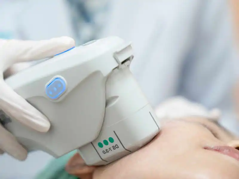 HIFU Facial Treatment: Unlock the Secrets to Non-Surgical Skin Tightening and Lifting