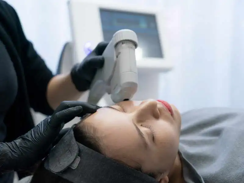 HIFU Facial Treatment: Unlock the Secrets to Non-Surgical Skin Tightening and Lifting