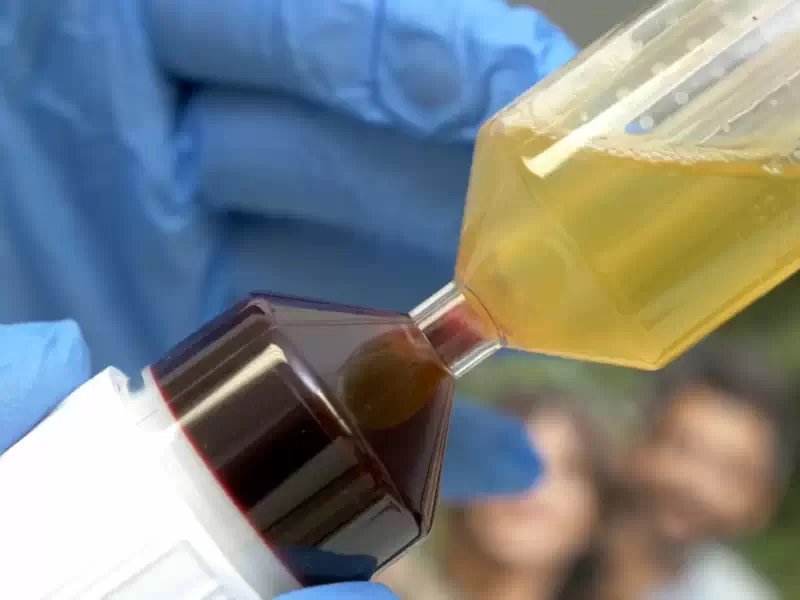 PRP Treatment Near Me for Hair Regrowth: Your Solution to Hair Loss