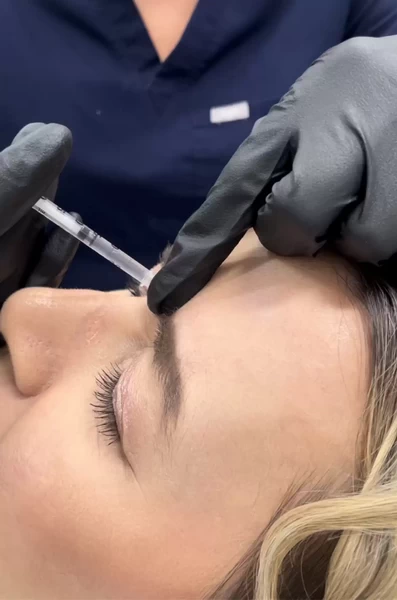How Long After Botox Can You Exercise?