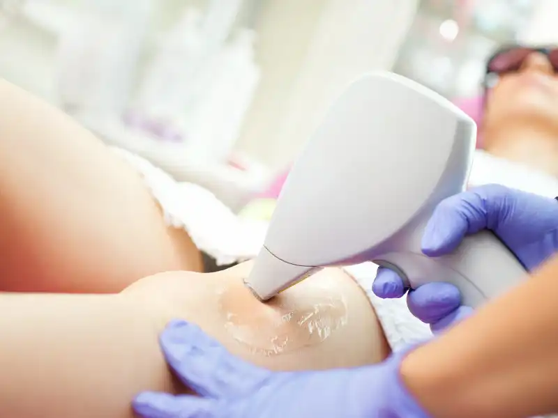 Laser Hair Removal: Everything you need to know