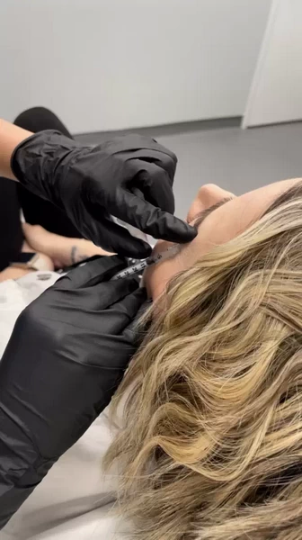 How Long After Botox Can You Exercise?