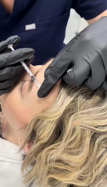 How Long After Botox Can You Exercise?