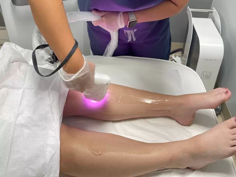 Effective & Painless Laser Hair Removal Near Me