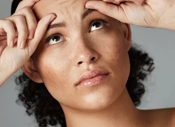 Preventative Botox: How Botox Can Help Prevent Aging