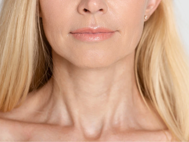 The #1 Best Way to Treat Neck Wrinkles: Juvederm’s SkinVive