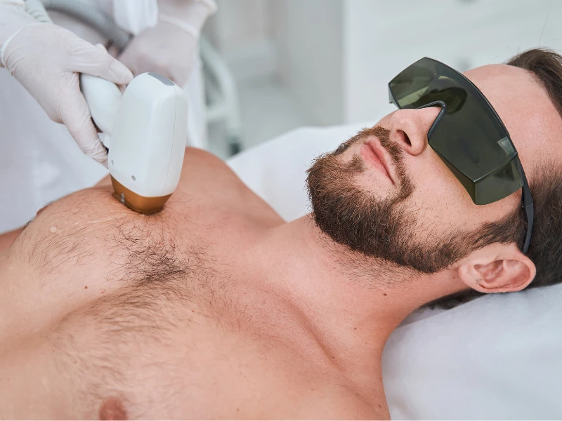Here is Why You Should Consider Laser Hair Removal For Men