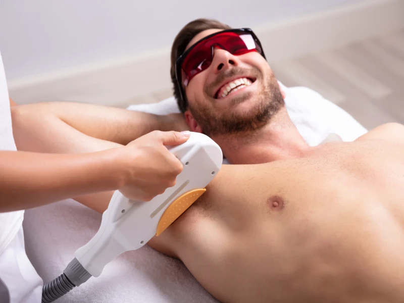 Here is Why You Should Consider Laser Hair Removal For Men