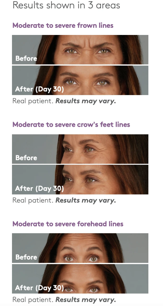 Preventative Botox: How Botox Can Help Prevent Aging