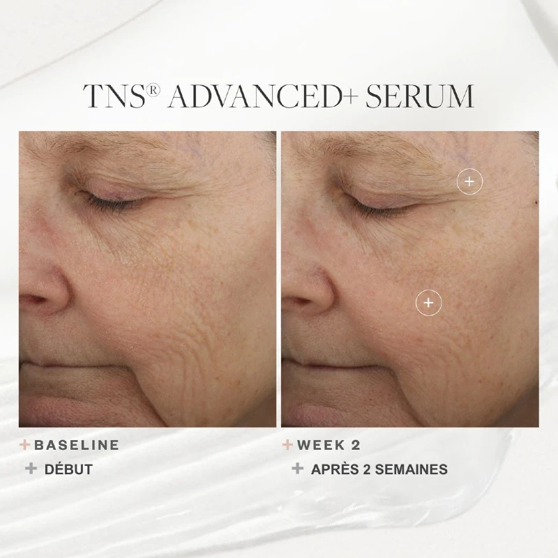 Anti-Aging Skincare for Aging Skin: SkinMedica