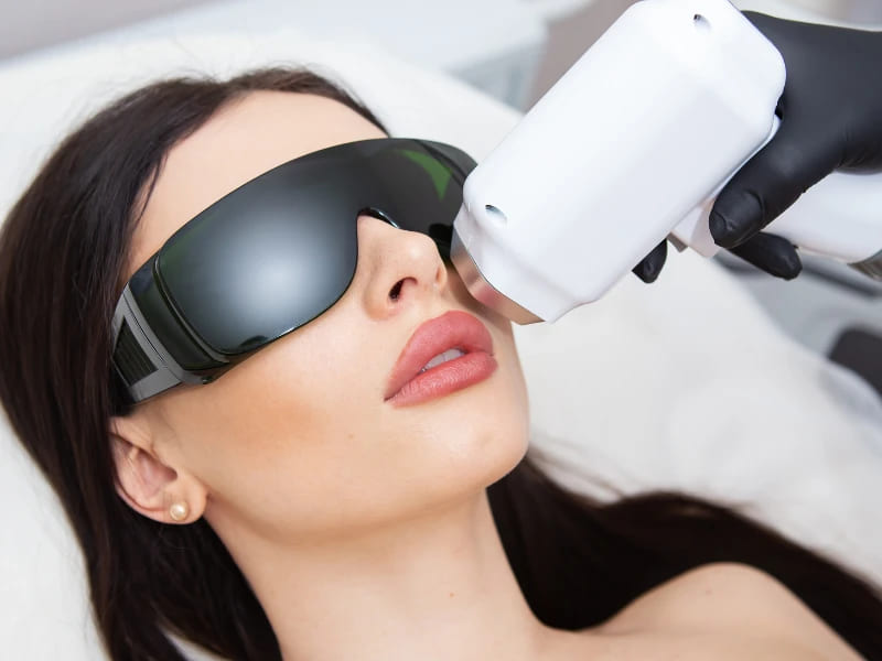 IPL Vs BBL Light Therapy for Skin