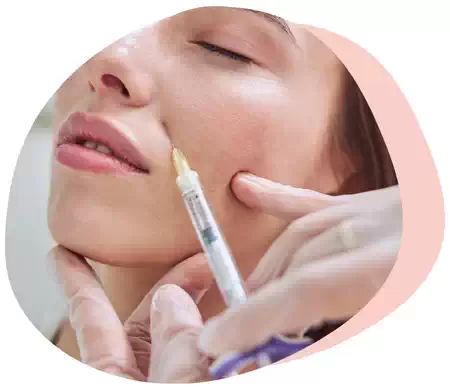 dermal fillers