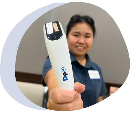 DermaPen Microneedling treatment