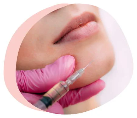 Juvederm DermalFillers