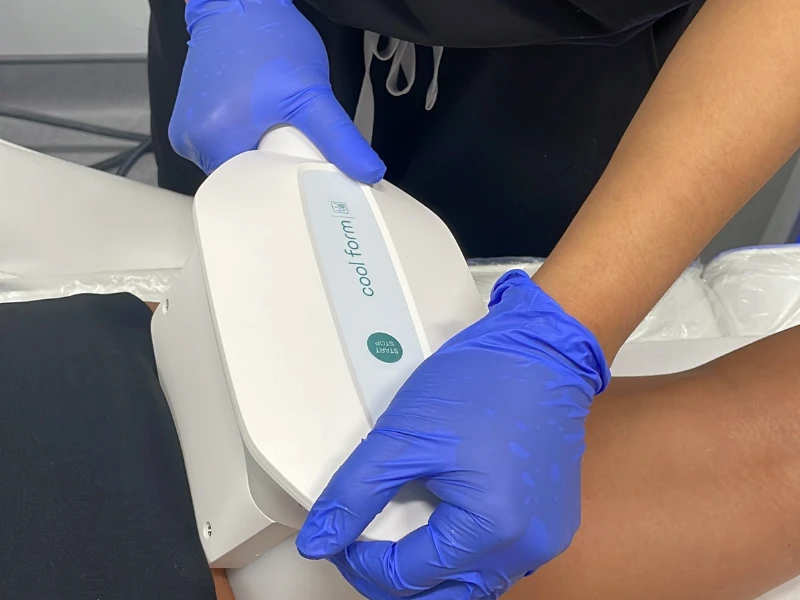 Permanent Fat Reduction Without Surgery With Cool Form Non-Surgical Fat Removal