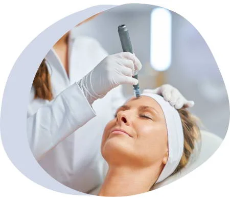 Radiofrequency Microneedling