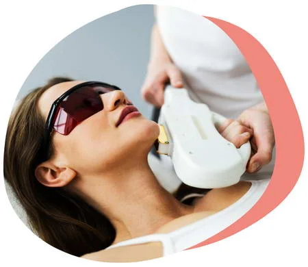 REFRESH Radiofrequency (RF) therapy
