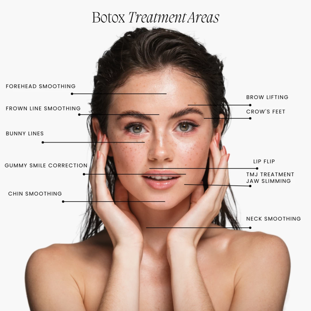 What Are the Top 10-Facial Areas for Botox Treatment