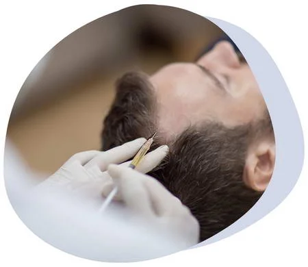 PRP Hair Restoration