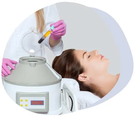 PRP Facial Treatment