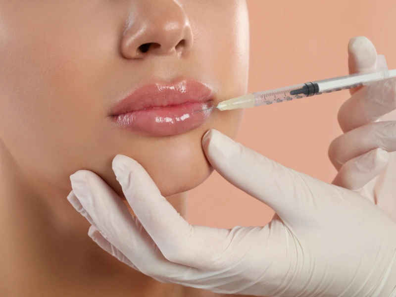 Debunking The Top 4 Common Myths About Dermal Fillers