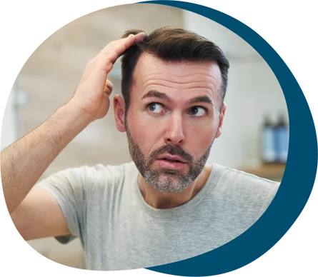 PRP Hair Restoration