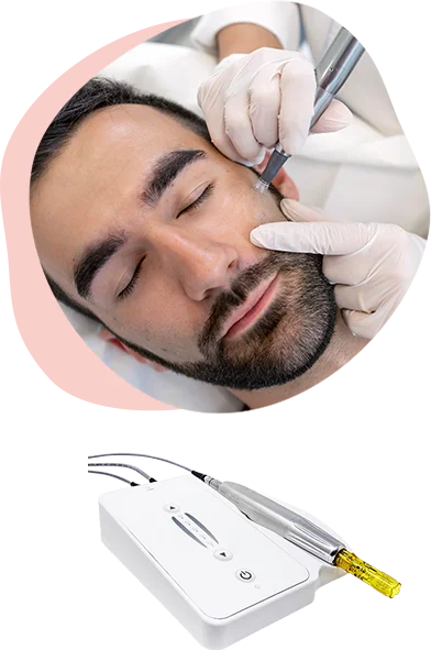 DermaPen Microneedling treatment